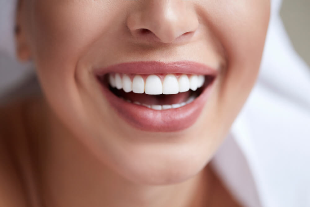 Healthy White Smile Close Up