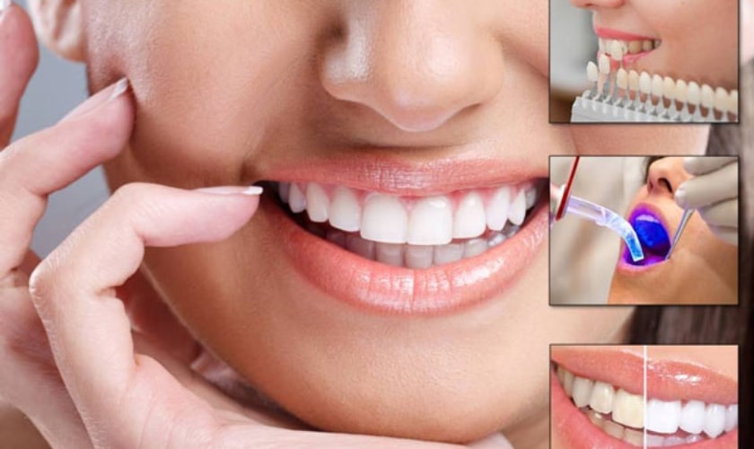 How to Choose the Right Cosmetic Dentist for Your Smile Makeover